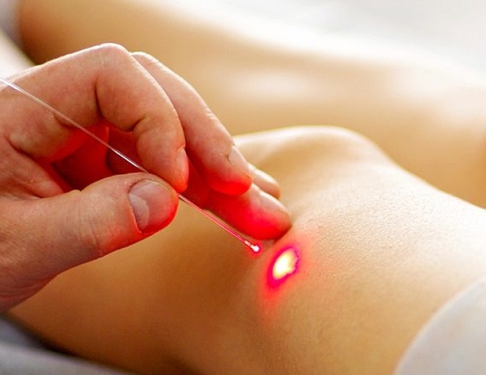 Магнито- и лазеротерапия - Пансионат ФЕЯ-2 SUNBEACH RESORT